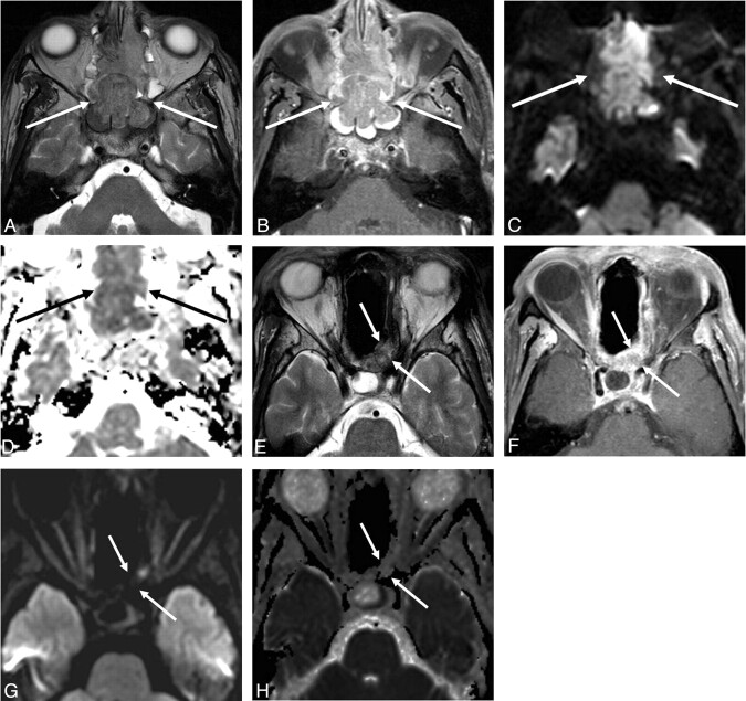 Fig 5.