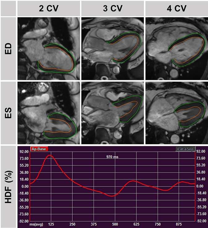 Fig. 3