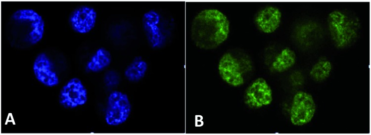 Fig. 17