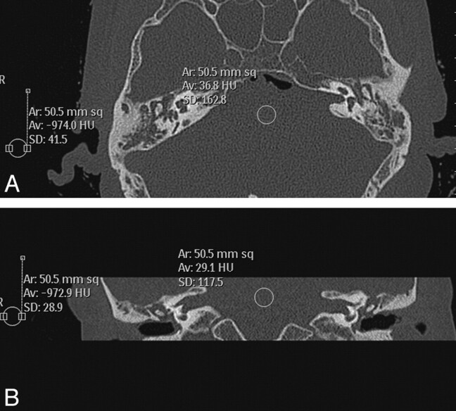 Fig 2.