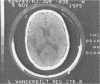 199