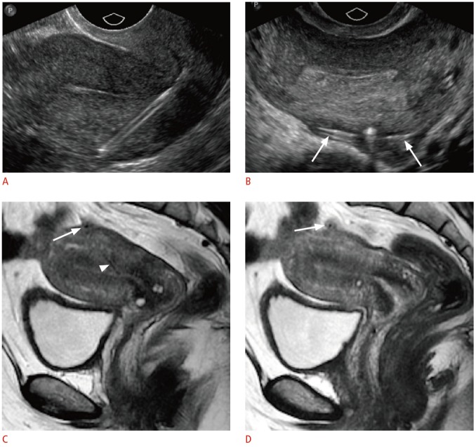 Fig. 11.