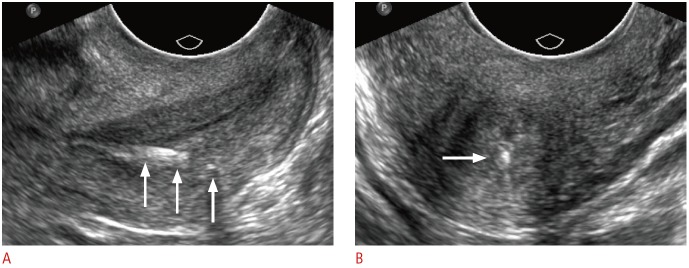 Fig. 13.