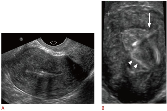 Fig. 10.