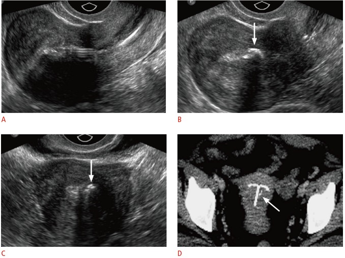 Fig. 14.