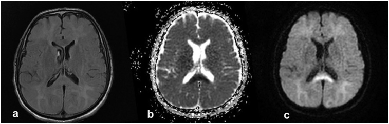 Fig. 1