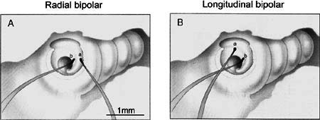 Figure 10