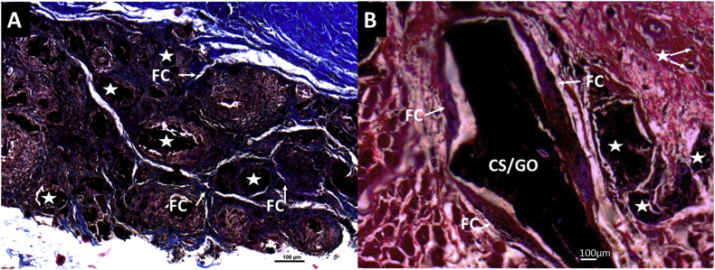 Figure 11