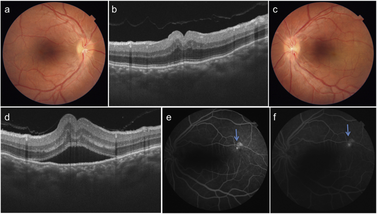 Fig. 3