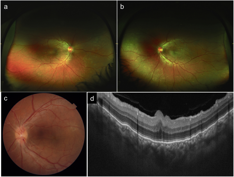 Fig. 4