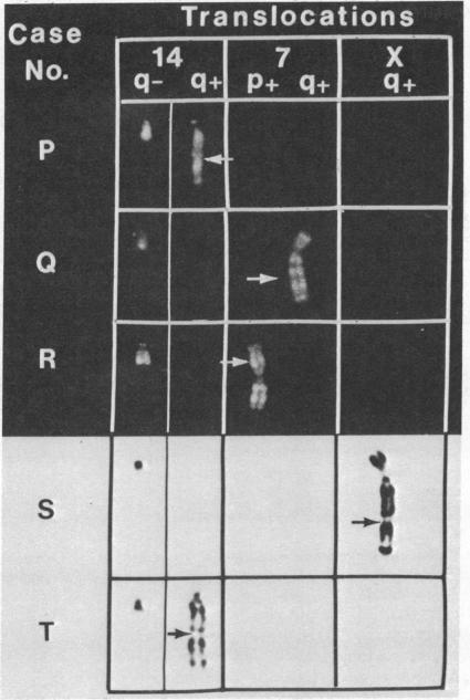 graphic file with name pnas00049-0099-a.jpg