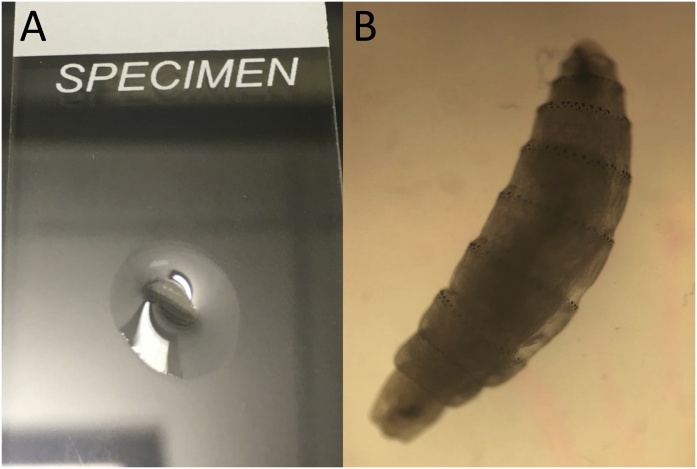 Fig. 1