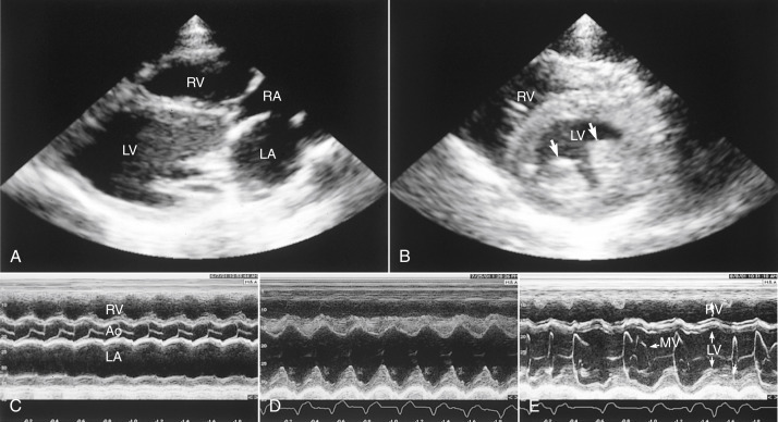 Fig. 20-3