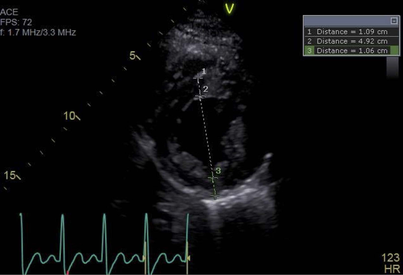 Figure 1: