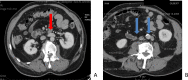 Fig 4 –