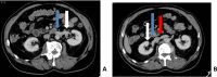 Fig 2 –