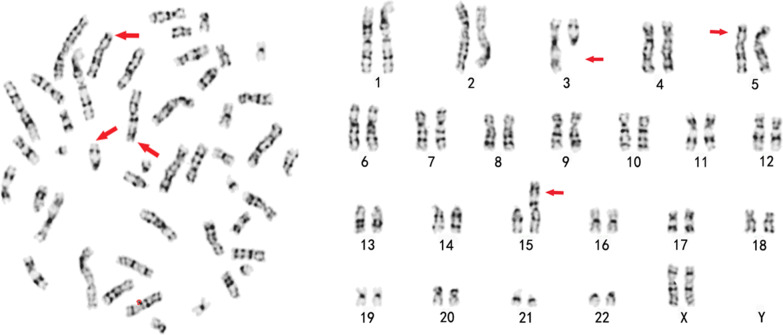 Fig. 2