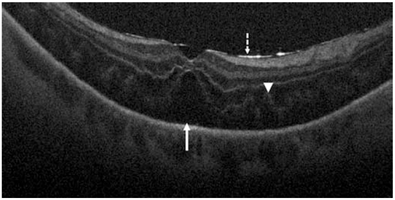 Figure 9