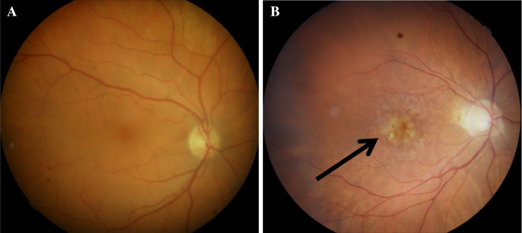 Fig. 2