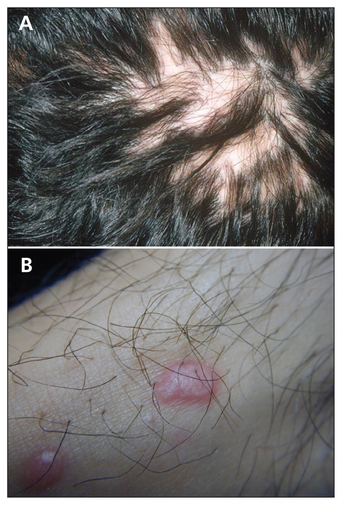Figure 2: