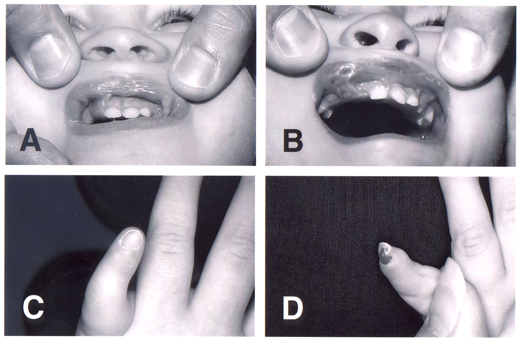 Figure 1: