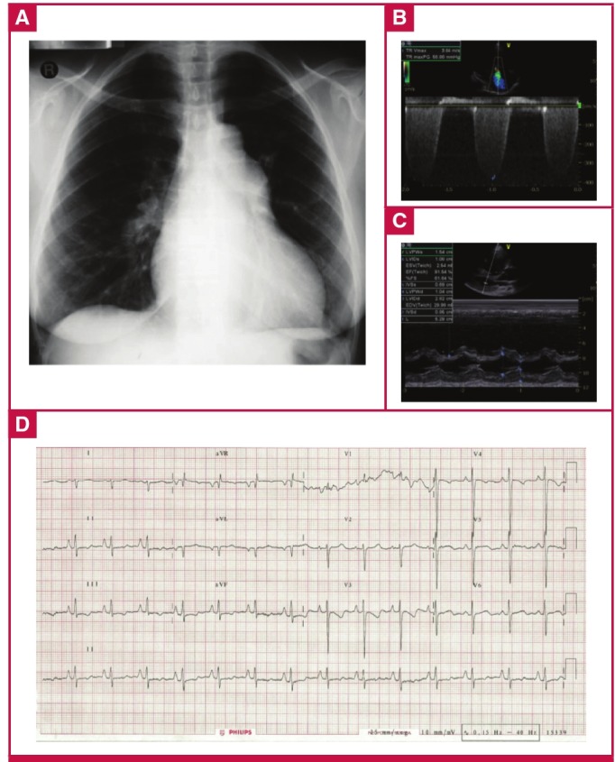 Fig. 3