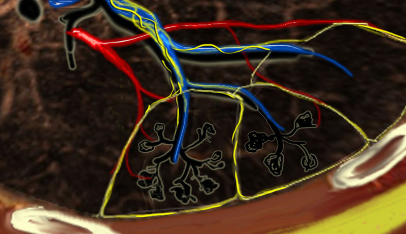 Secondary lobules. The centrilobular artery (blue) and the terminal bronchiole run in the center. Lymphatics (yellow) and veins (red) run within the interlobular septa. (Reprinted, with permission, from reference 23.)