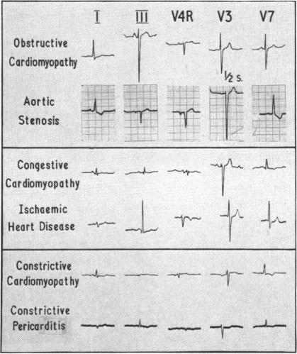 graphic file with name brheartj00350-0098-a.jpg