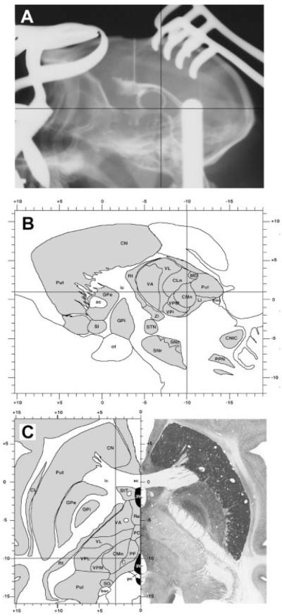 FIG. 1