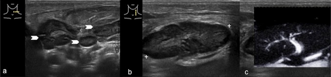 Fig. 6