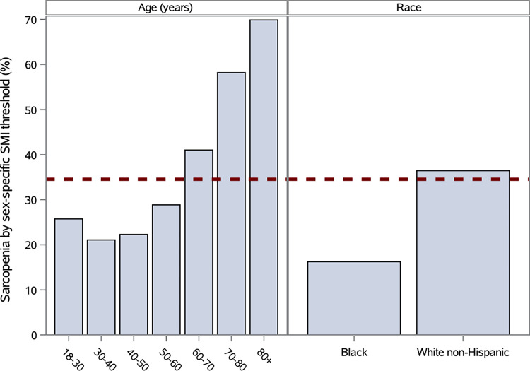 Bar charts show comparison proportion of patients classified with sarcopenia with varying age and race categories by standard method with sex-specific skeletal muscle index (SMI) threshold for calculating sarcopenia (35% of patients in total) versus skeletal muscle index z-score threshold of −0.40 corresponding to 35% of population across age, race, and sex (dotted line).