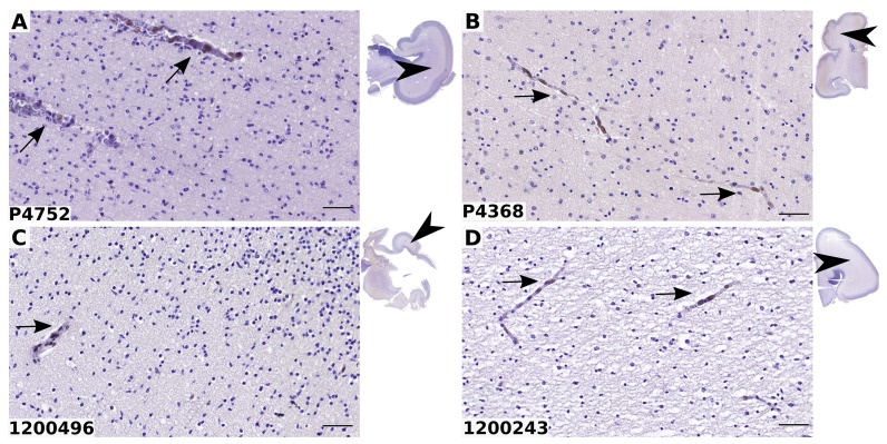 Fig 11