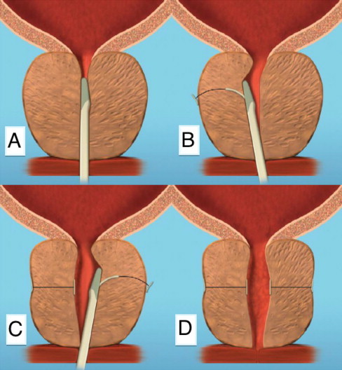 Fig. 2