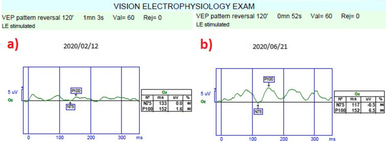 Fig. 11