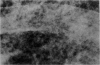 1062-1