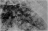 1062-1