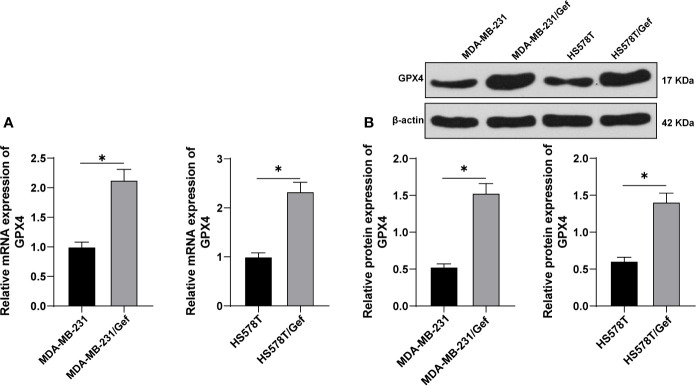 Role of GPX4-Mediated Ferroptosis in the Sensitivity of Triple Negative ...