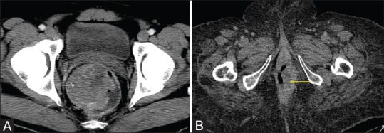 Figure 10 (A and B)