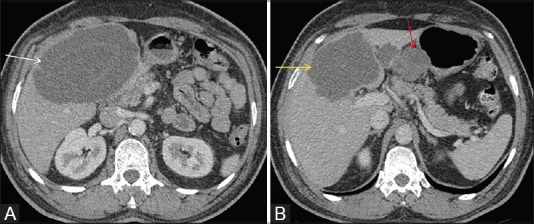 Figure 13 (A and B)