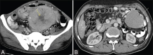 Figure 11 (A and B)