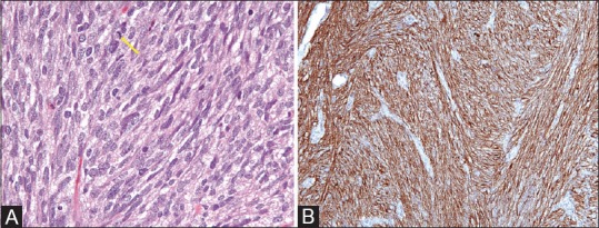 Figure 1 (A and B)