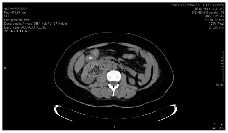 Fig. 2