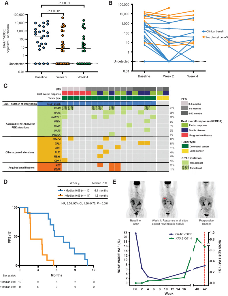 Figure 4. Early ctDNA dynamics and genomic alterations at disease progression. A, Dynamics of BRAF V600E mutant DNA copies/mL between baseline, week 2 and week 4 of treatment, n = 25, BL-W2: P < 0.001, BL-W4: P < 0.01. Wilcoxon signed-rank test. B, Dynamics of BRAF V600E mutant DNA copies/mL between baseline, week 2 and week 4 of treatment according to clinical benefit rate. (BL-W2: P = 0.0001; median change −176.4 and BL-WK4: P = 0.0002, median change −188.7 copies/mL, respectively). C, Summary of ctDNA genomic features at disease progression in 18 patients with an available progression plasma sample. Patients are ordered according to time to progression. Each column represents an individual patient, and each row indicates a specific acquired alteration. D, Kaplan–Meier estimate of PFS for patients (n = 21) stratified by week 2-baseline ratio (W2-BLR). E, Serial ctDNA analysis of a patient with BRAF V600E mutation positive colorectal cancer treated in the dose-escalation phase of the EViCT trial. This patient with de novo metastatic colorectal cancer progressing after first-line FOLFOX chemotherapy and bevacizumab, subsequently received vemurafenib and erlotinib on the EVICT clinical trial. ctDNA levels at baseline showed the detectable BRAF V600E mutation with undetectable KRAS Q61H mutation. After 4 weeks of treatment, FDG-PET scan showed a favorable response in all the known metastatic sites of disease. Correspondingly, BRAF V600E VAF decreased from baseline to week 4, confirming a response to therapy. However, there was evidence of a new FDG-avid hepatic nodule suggesting a refractory clonal population. At that time point, ddPCR identified the emergence of the KRAS Q61H, but the signal was below our defined detection threshold (see Materials and Methods). The KRAS mutation levels gradually increased across serial samples with detection confirmed at 16 weeks. Despite confirmation of stable disease by RECIST criteria at this time point, there was evidence of a steady increase in BRAF V600E ctDNA levels from week 16 onwards until the time of disease progression.