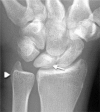 Figure 1:
