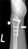 Figure 4: