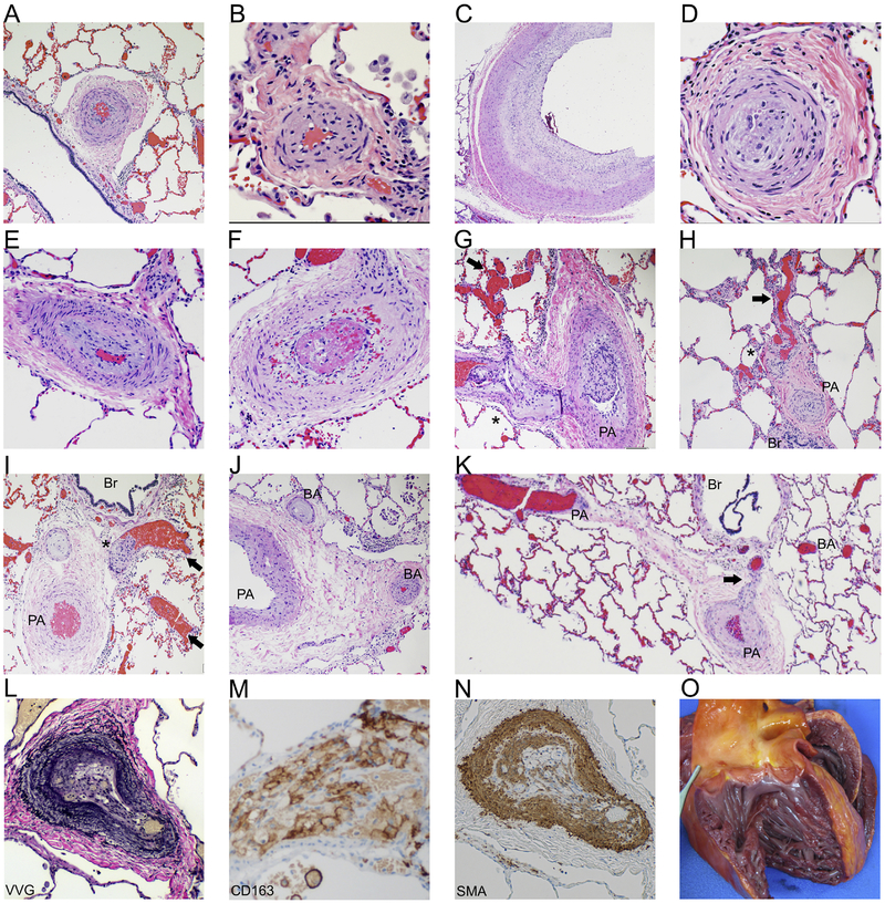 Figure 2: