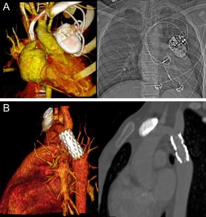 Figure 17