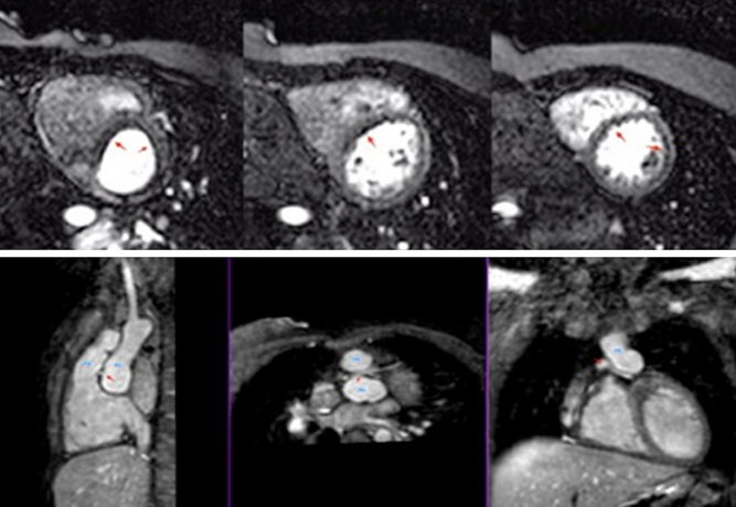 Figure 13