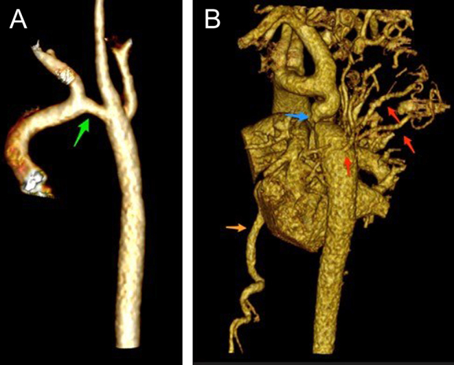 Figure 18