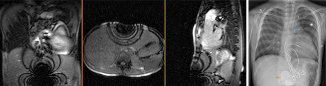 Figure 15